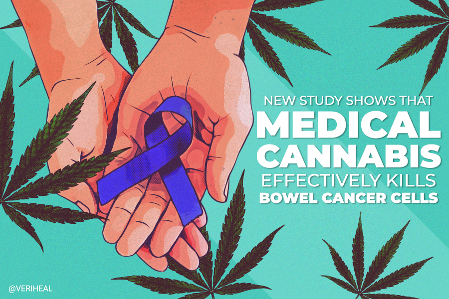 Biotechnology Company’s Study Spotlights Medical Cannabis as a Potential Cure for Bowel Cancer