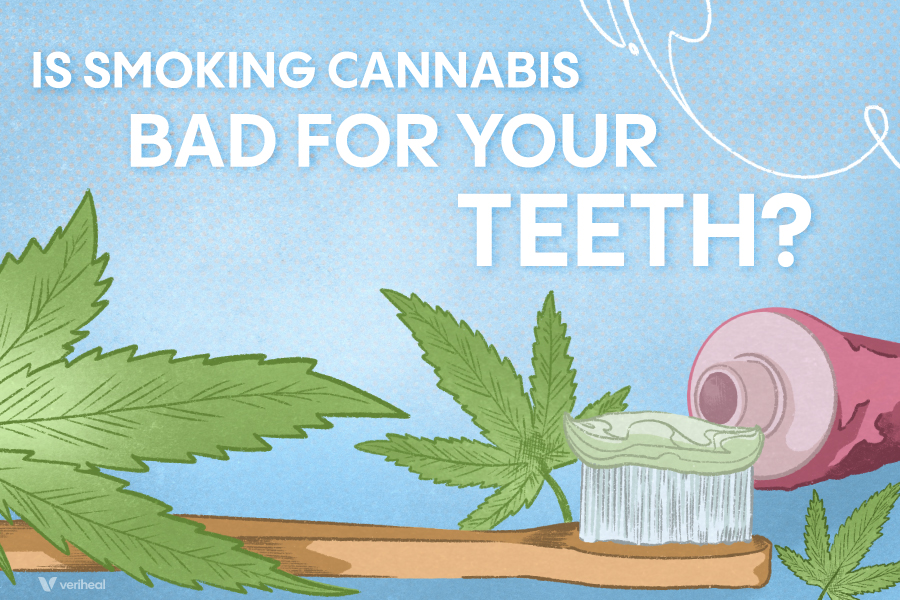 Is Smoking Cannabis Bad for Your Teeth?