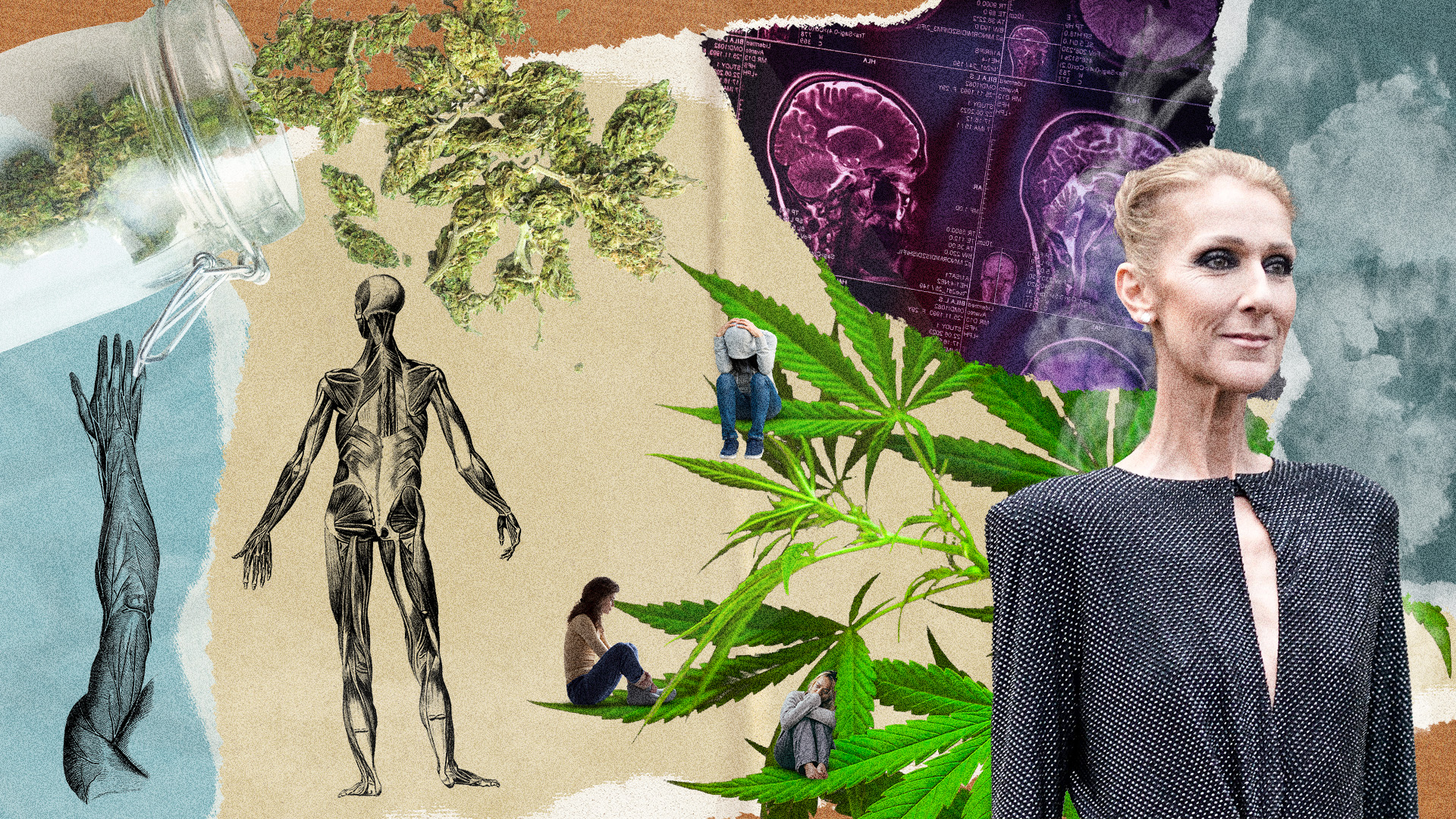 Medical Cannabis Could Help Combat Symptoms of Stiff Person Syndrome