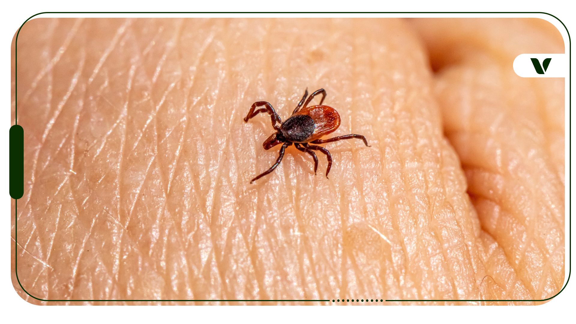 Potential Best Practices for Managing Lyme Disease Symptoms with Cannabis