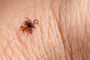 A tick on a human body