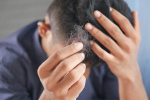 man suffering hair loss