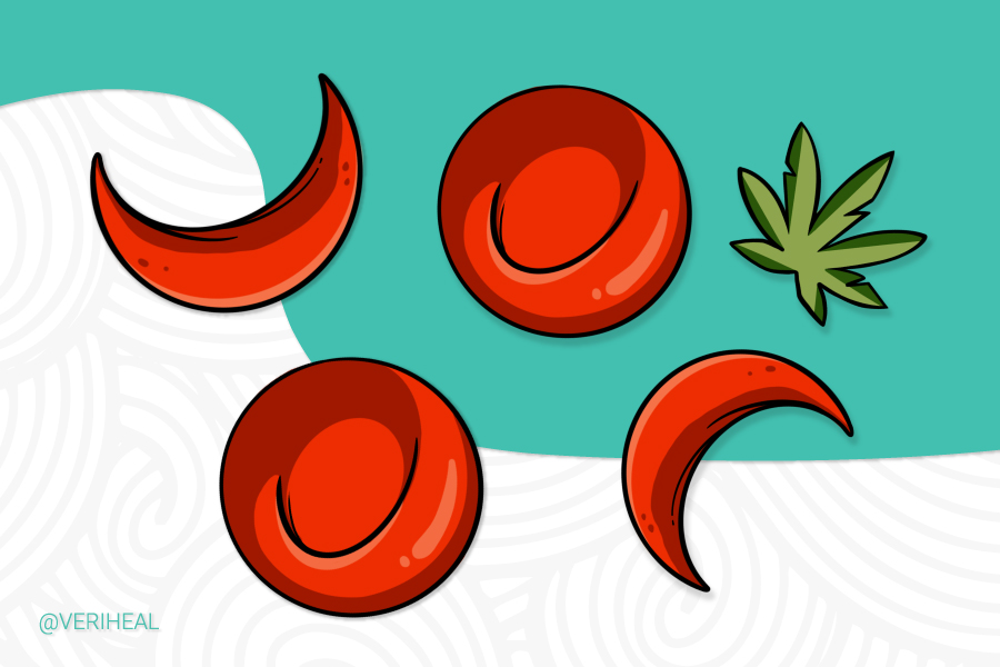 A New Study Shows Cannabis Treatment Potential For Sickle Cell Disease