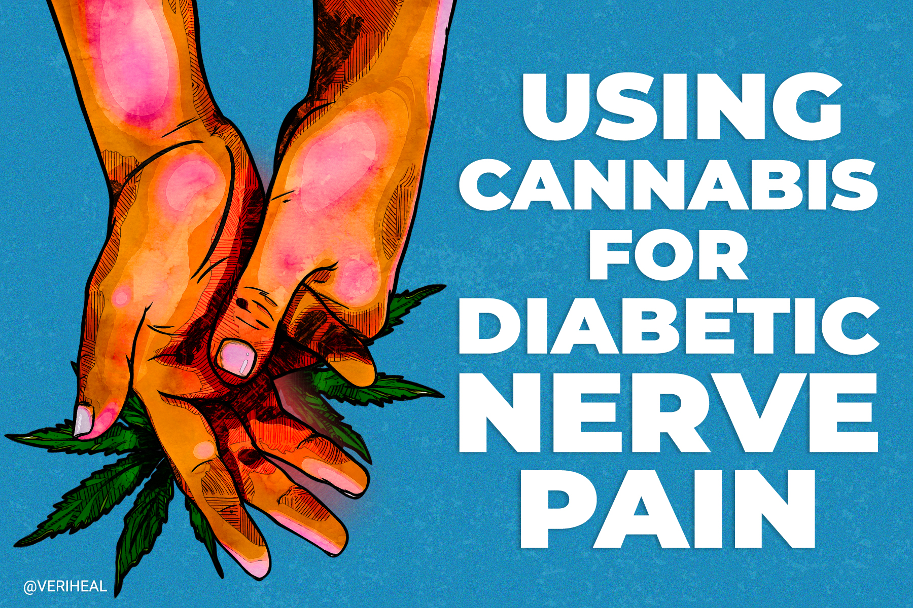 THC Can Effectively Reduce Diabetic Nerve Pain, Study Says