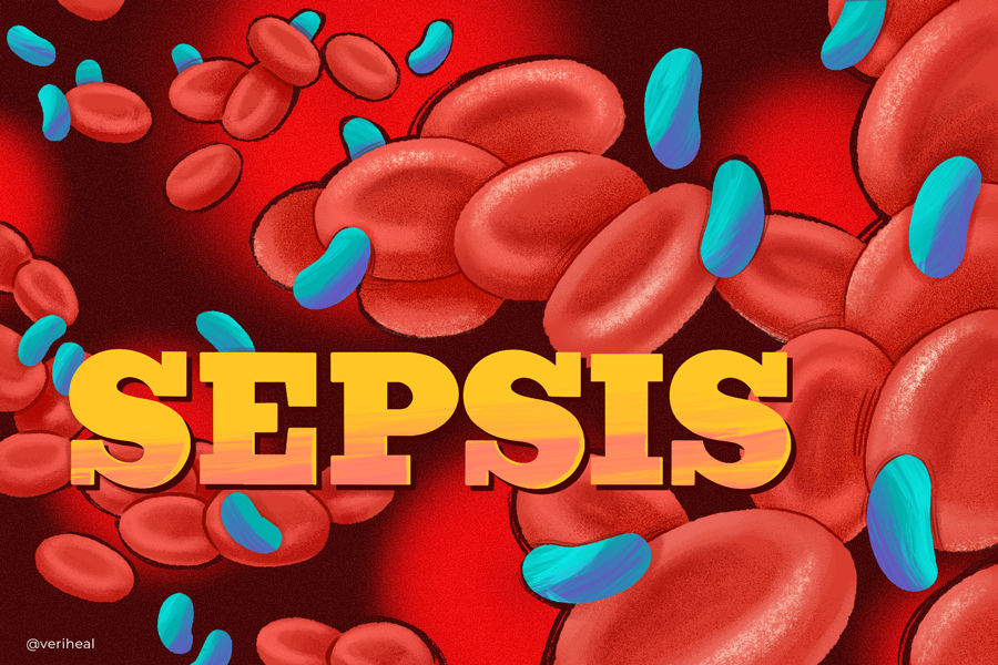 Sepsis